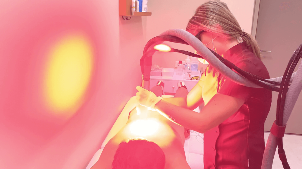 épilation laser Chaponost