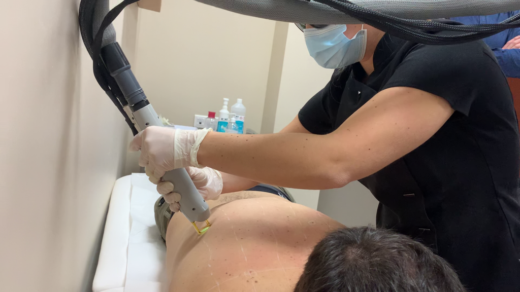 épilation laser Saint-Genis-Laval